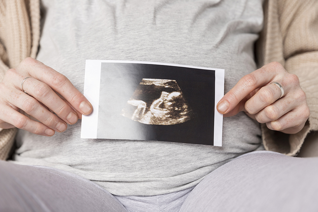 Gambar 1 - pentingnya usg di awal kehamilan