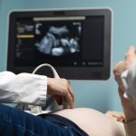 Lengkap! Daftar Pertanyaan saat USG Kehamilan Tiap Trimester agar Ibu Hamil Tidak Bingung