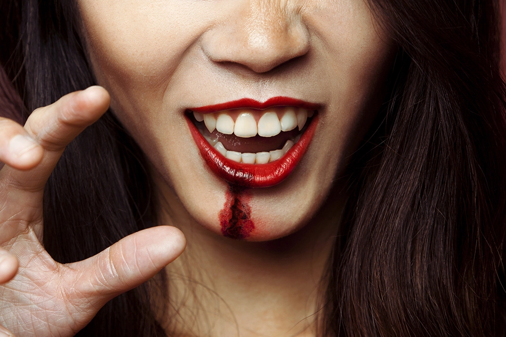 Gambar 1 - Cara mengobati bibir luka karena benturan 