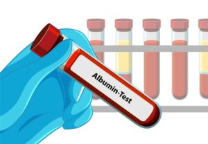Gambar 1 - cara menaikan albumin dengan cepat
